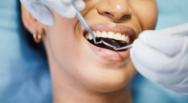 Best Emergency Dental Care for Broken or Chipped Teeth in , TX